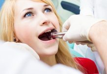 Tips for Getting Your Wisdom Teeth Extracted Wisdom Teeth Extracted